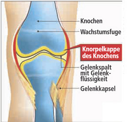 Arthrosen, Knorpel, Gelenksverschlei, Regenerationsfhigkeit